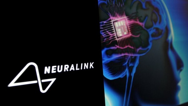 Человек с имплантом Neuralink рассказал, что пользуется им почти весь день